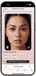 AI aesthetic simulator preview - after